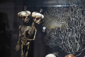 «Уродцев» убрали из Кунсткамеры? Рассказываем, что случилось со старейшим музеем и как на это реагируют сотрудники и гости