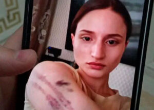 Следствие по убийству Айшат Баймурадовой продолжается. СK SOS опубликовала список того, что можно сделать, чтобы расследование было эффективным